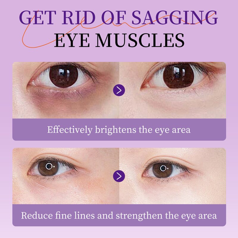 Eye Cream Manufacturer - In Stock Anti Puffiness Smoothing Anti Aging Nourishing Removal Dark Circles