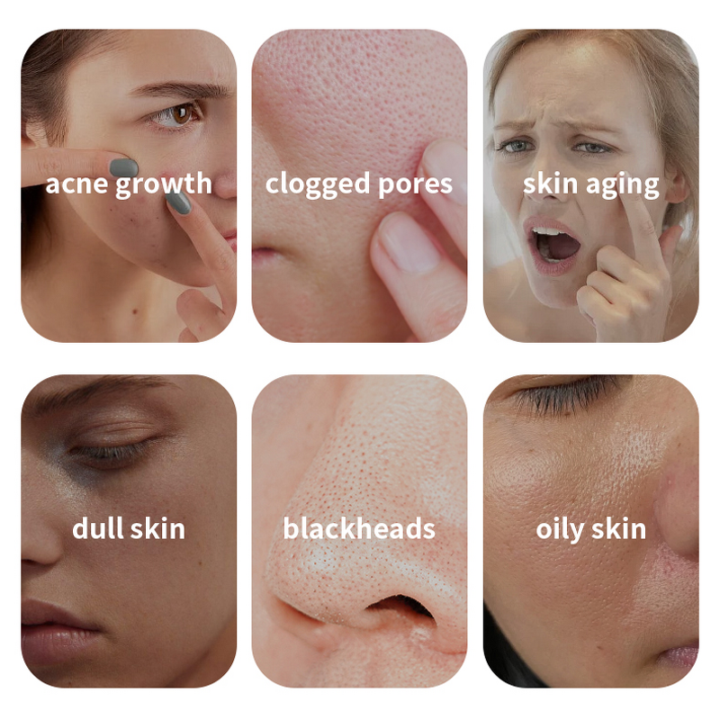 Mud Clay Mask Manufacturer - DOLAI Skin Care Organic Green Tea Deep Cleansing Blackheads Remover Moisturizing