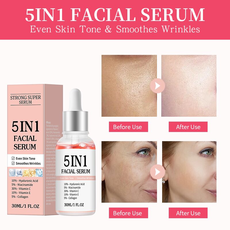 Vitamin C Serum Manufacturer - 5 in 1 Whitening Anti Age 30% Vitamin C 5% Niacinamide 10% Vitamin E