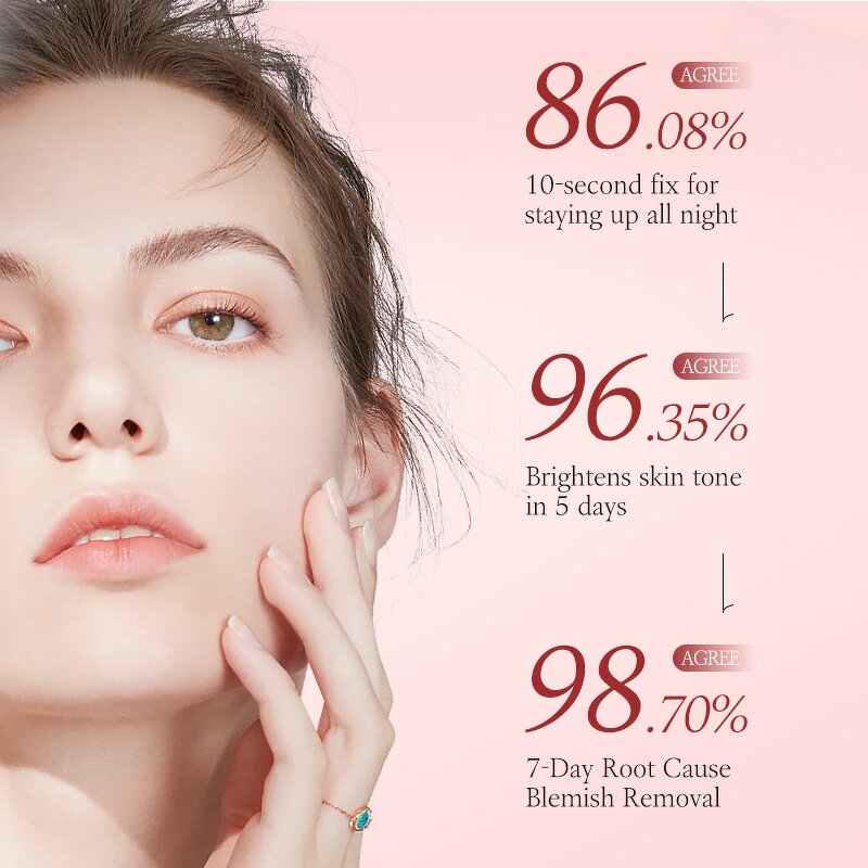 Niacinamide Serum Manufacturer - Ready Ship 10% Lightening Whitening Dark Spot Removal 30ml