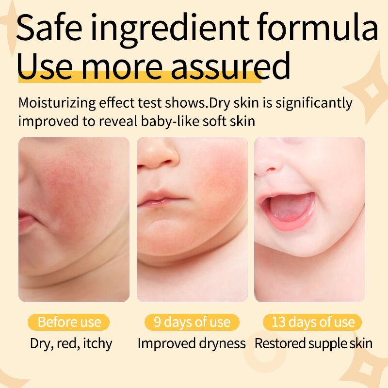 Animal Sheet Mask Manufacturer - Children Moisturizing Cat Custom Shape Nourish Print 5 Pieces/box