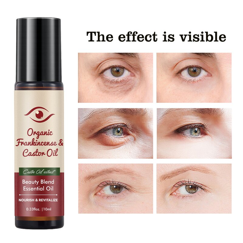 Eye Essential Oil Manufacturer - Sandalwood Remove Fine Lines Castor Olive Oil Cold Roller Ball OEM/ODM