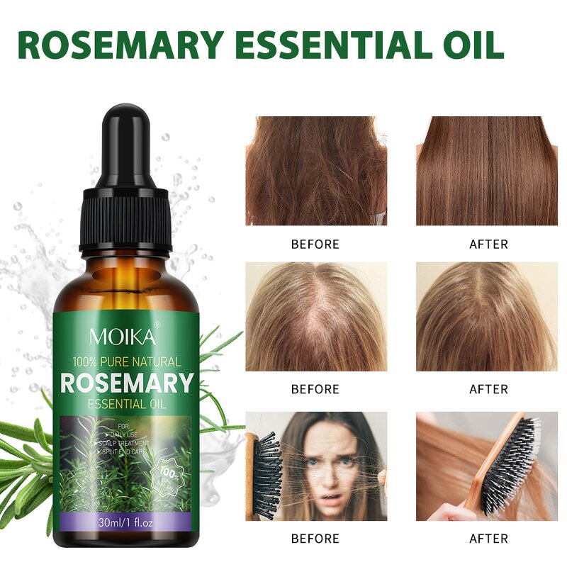 Scalp Treatment Oil Manufacturer - 100% Natural Organic Rosemary Castor Almond Men Women Scalp Private Label