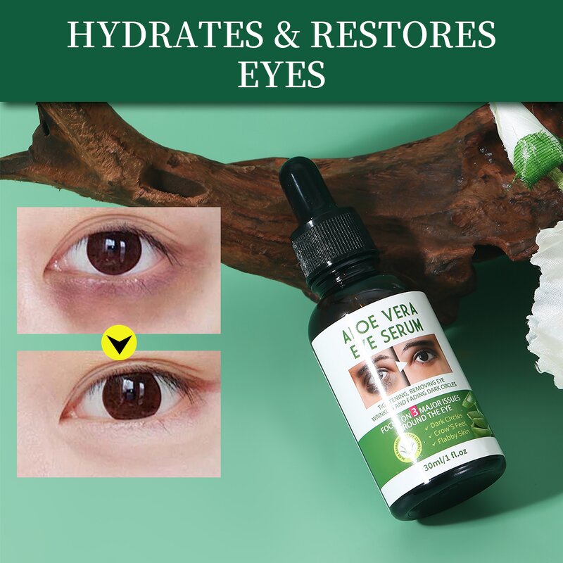 Eye Serum Manufacturer - Wholesale Organic Removal Fine Line Dark Circle Lifting Firming Aloe Vera