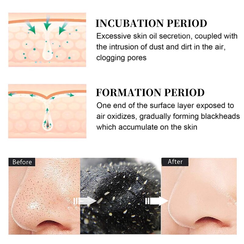 Nose Strips Manufacturer - Hot Selling Blackhead Original Magnetic Charcoal Nose Pore Removal