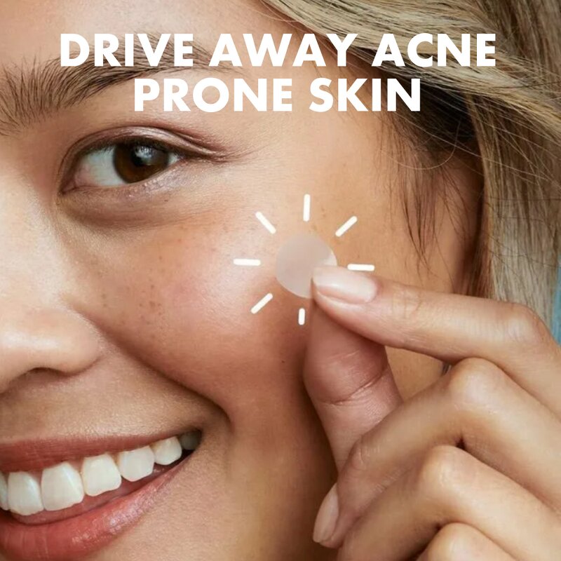 Acne Patch Manufacturer - Korean 36 Patches Hydrocolloid Facial Acne Products Dots for Spots