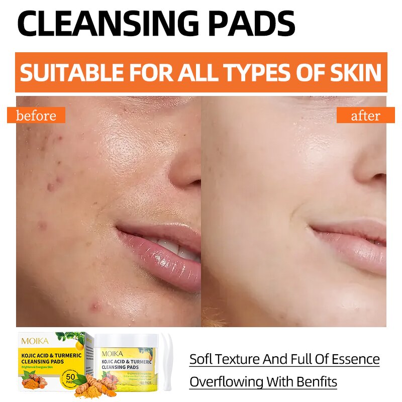 Turmeric Cleansing Pads Manufacturer - Kojic Acid 50 Pads Dark Spots Brightening Exfoliating Private Label