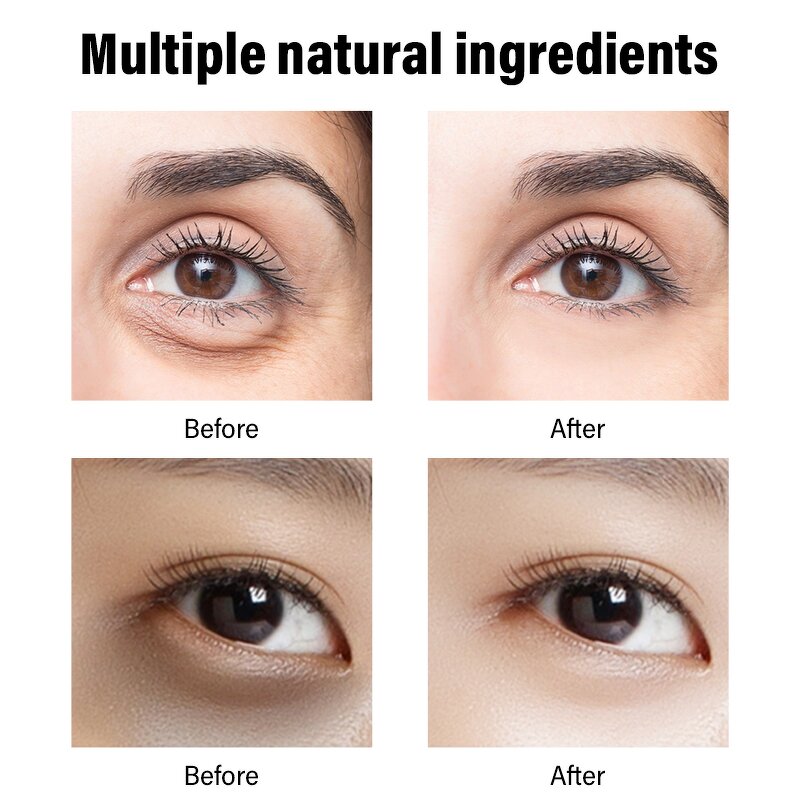 Eye Cream Manufacturer - Private Label Eye Bag Remover Lift Fast Anti Aging Anti-wrinkle Under Skin