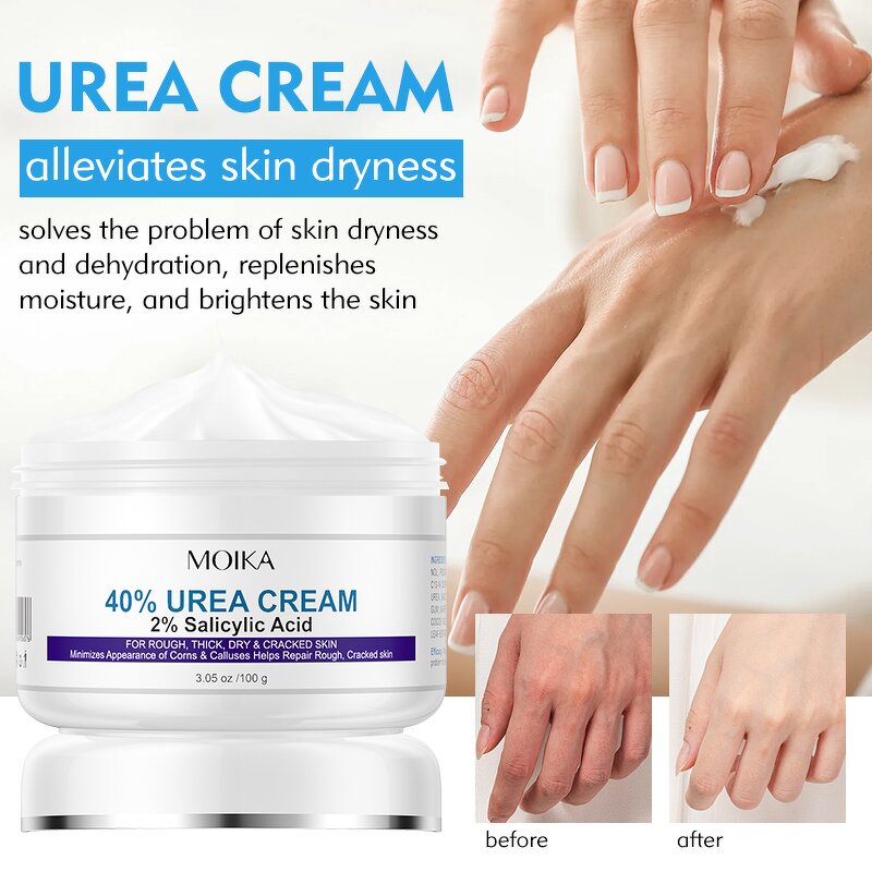 Urea Cream Manufacturer - Dry Cracked Feet Elbows Knees Repair 40% Urea Dead Skin Remover Body Care