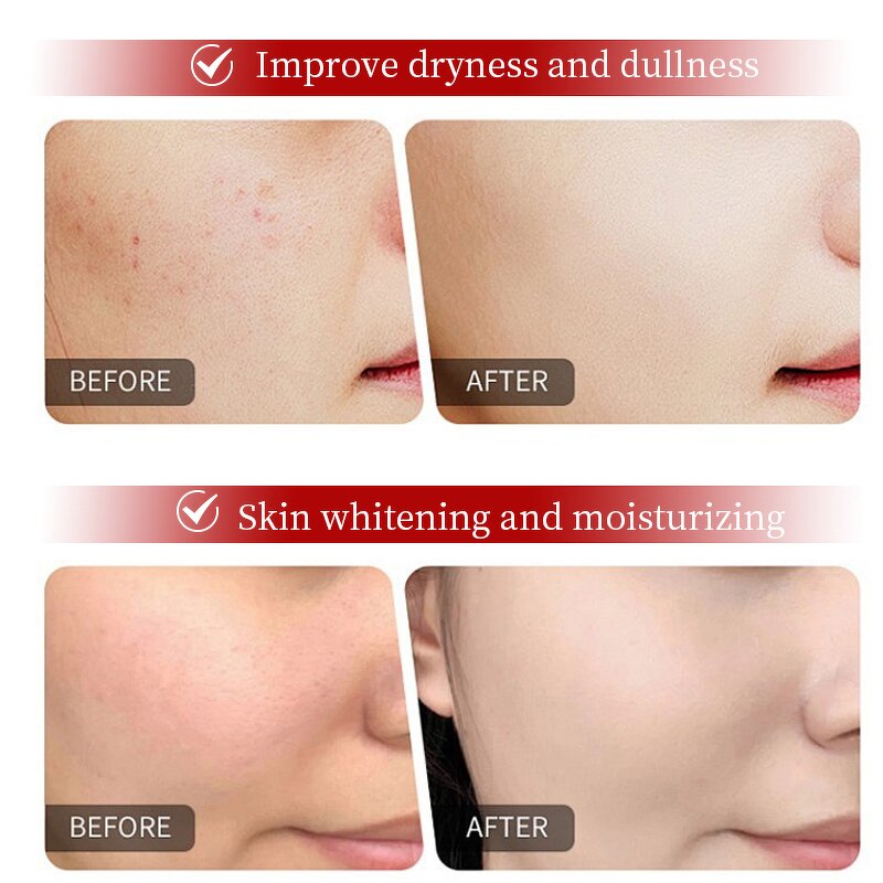 Anti-Aging Serum Manufacturer - Glutathione Niacinamide Wrinkles Dark Spots Vitamin C Retinol B3 OEM