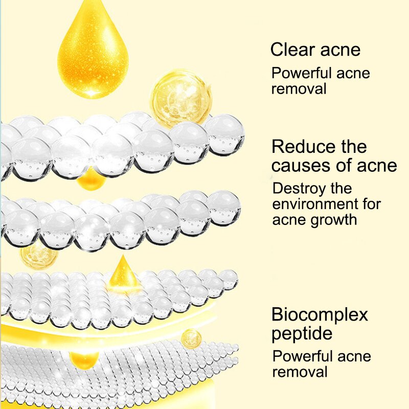 Acne Toner Essence Manufacturer - Hot Selling Salicylic Acid Removing Beauty Salons Acid Acne Wholesale OEM