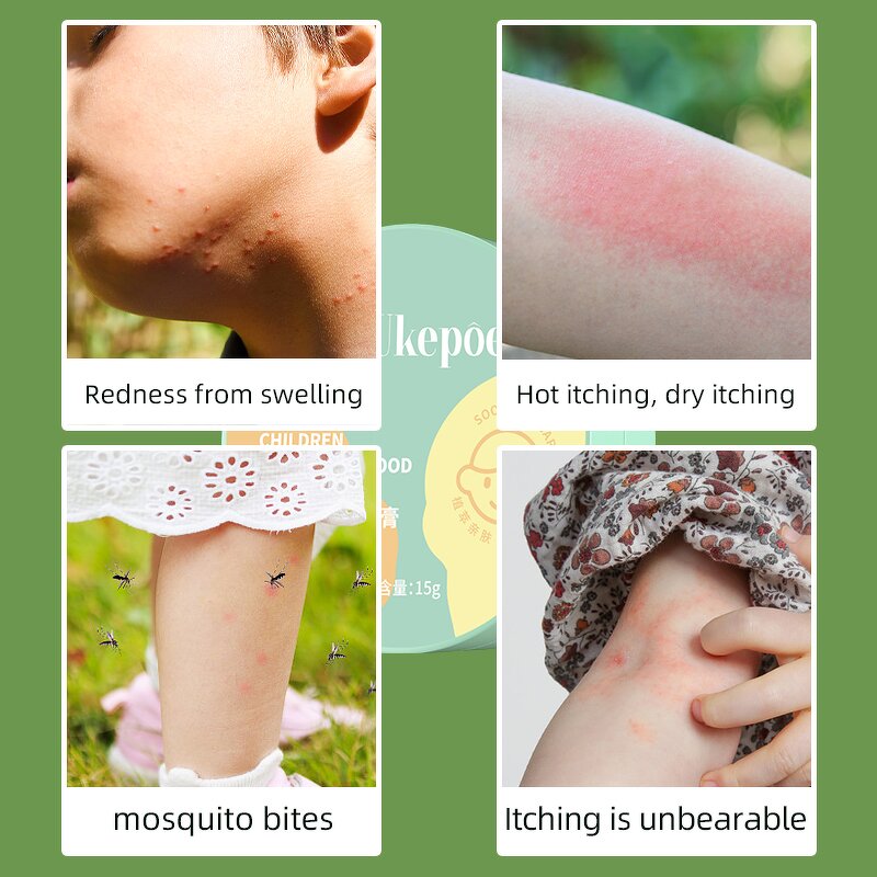 Baby Balm Manufacturer - Dropshipping Natural Baby Soothing Moisturizing Children Anti-itch Argy Wormwood