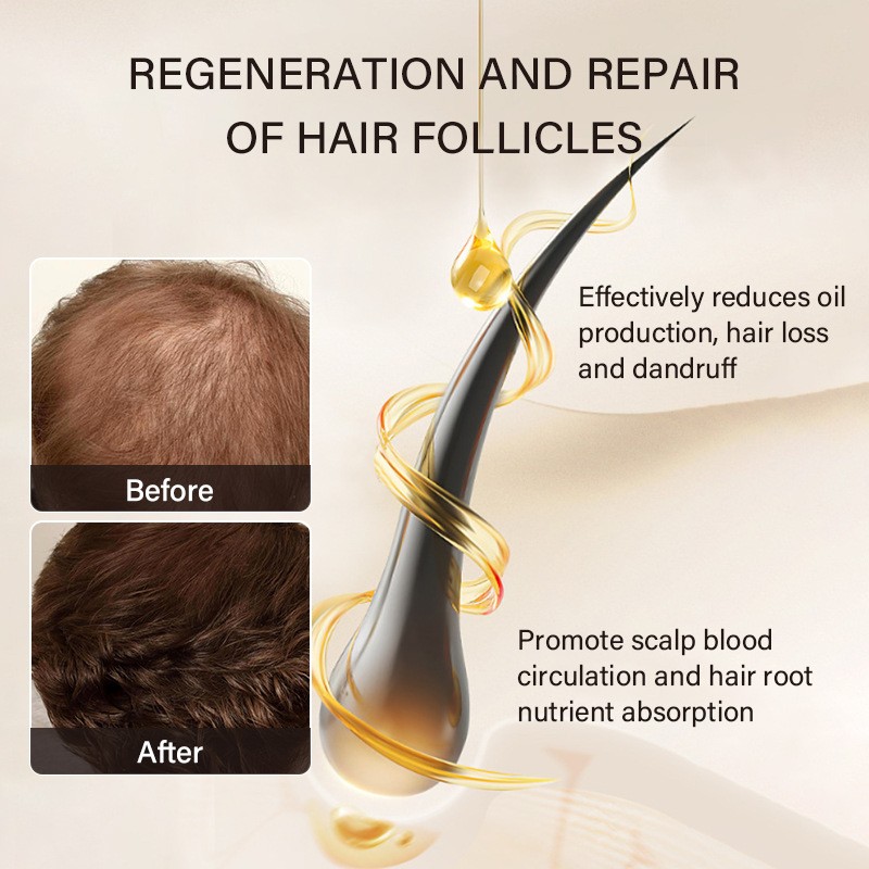 Castor Oil Manufacturer - OEM Organic Cold Pressed Hexane Free Hair Growth