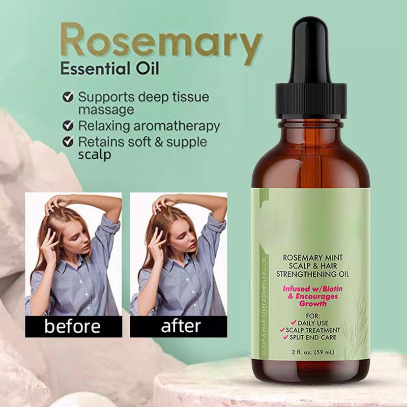 Hair Oil Supplier - Wholesale 59ml Rosemary Essential Oil Scalp Care