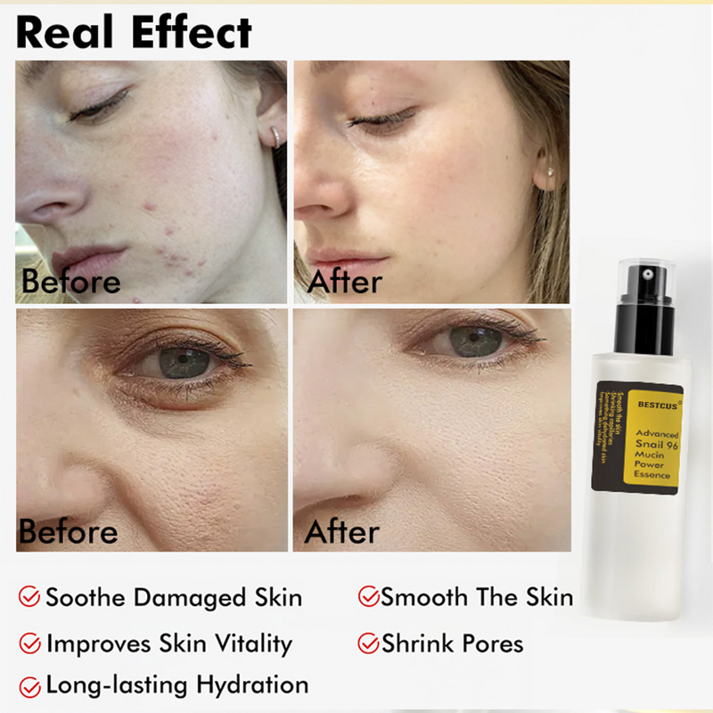 Kojic Acid Serum Manufacturer - Turmeric Dark Spots - Aged Spots Acne Brightening