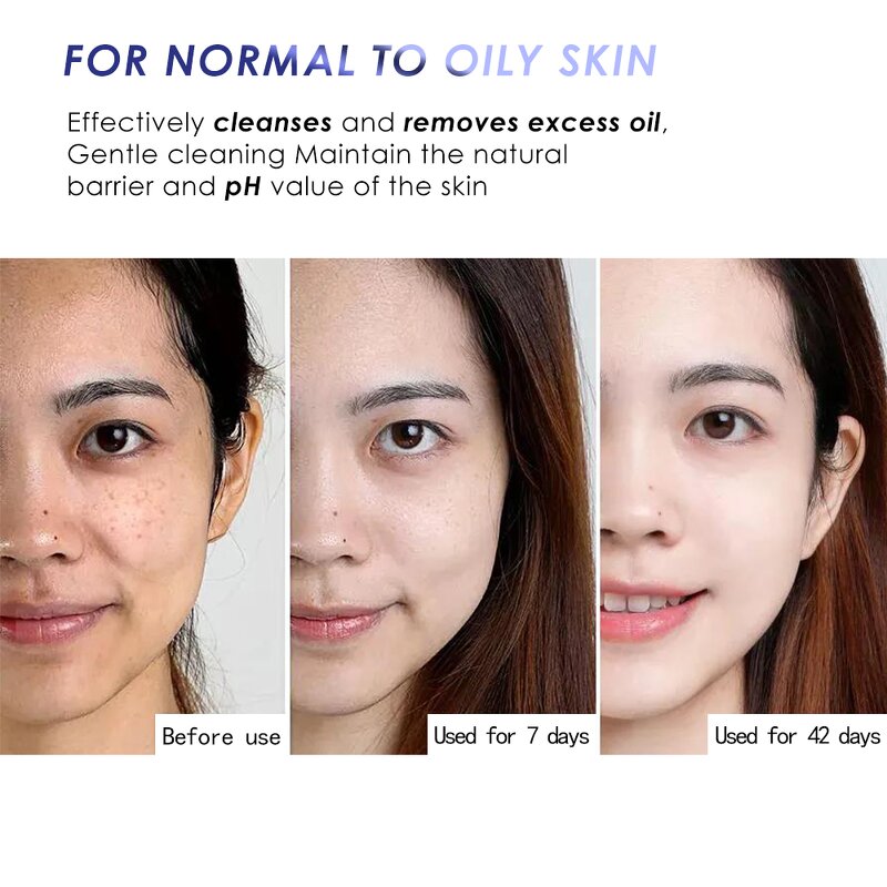 Facial Cleanser Manufacturer - Pore Control Blackheads - Vegan Amino Acid Gel