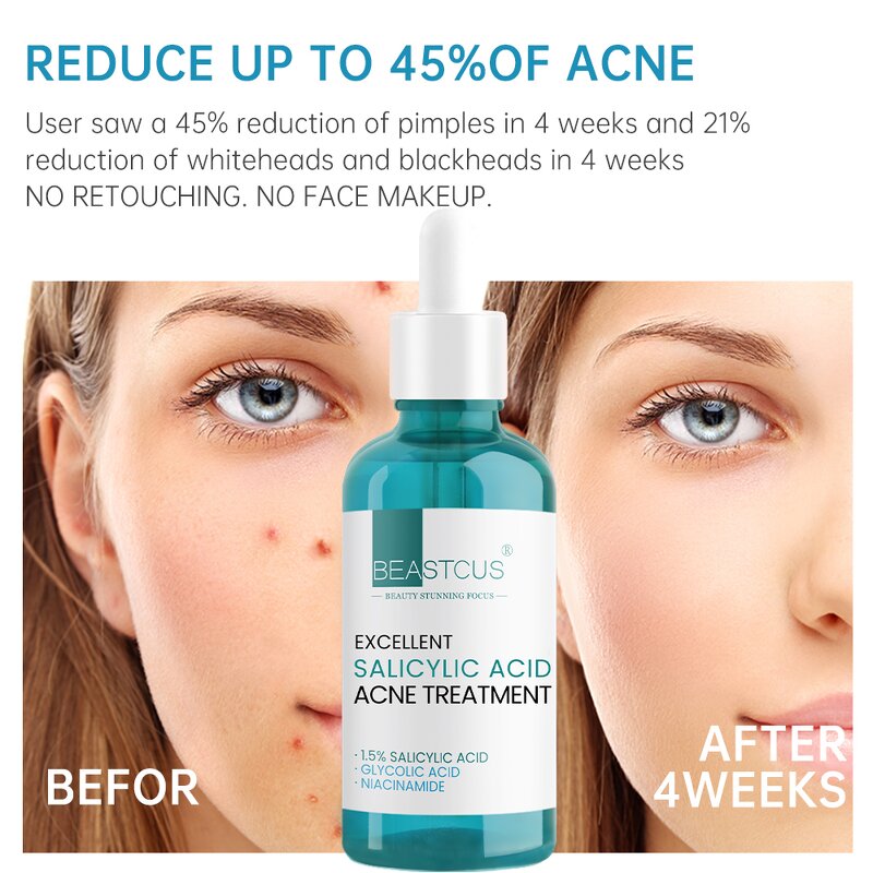 Acne Treatment Serum Manufacturer - Niacinamide Glycolic Acid 1.5% - Salicylic Acid