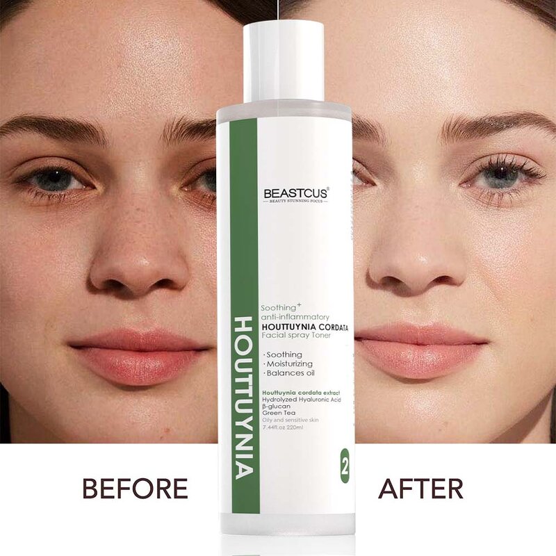 Skin Toner Manufacturer - Heartleaf Extract - Soothing & Hyaluronic Acid