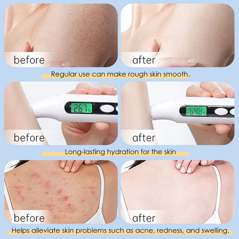 Body Lotion Manufacturer - Anti-aging Firm Moisturizing - 400ml Niacinamide Wholesale