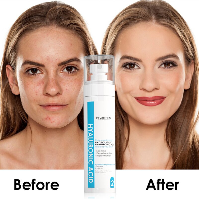 Skin Toner Manufacturer - OEM ODM Triple Moisturizing - Korean Skincare Wholesale