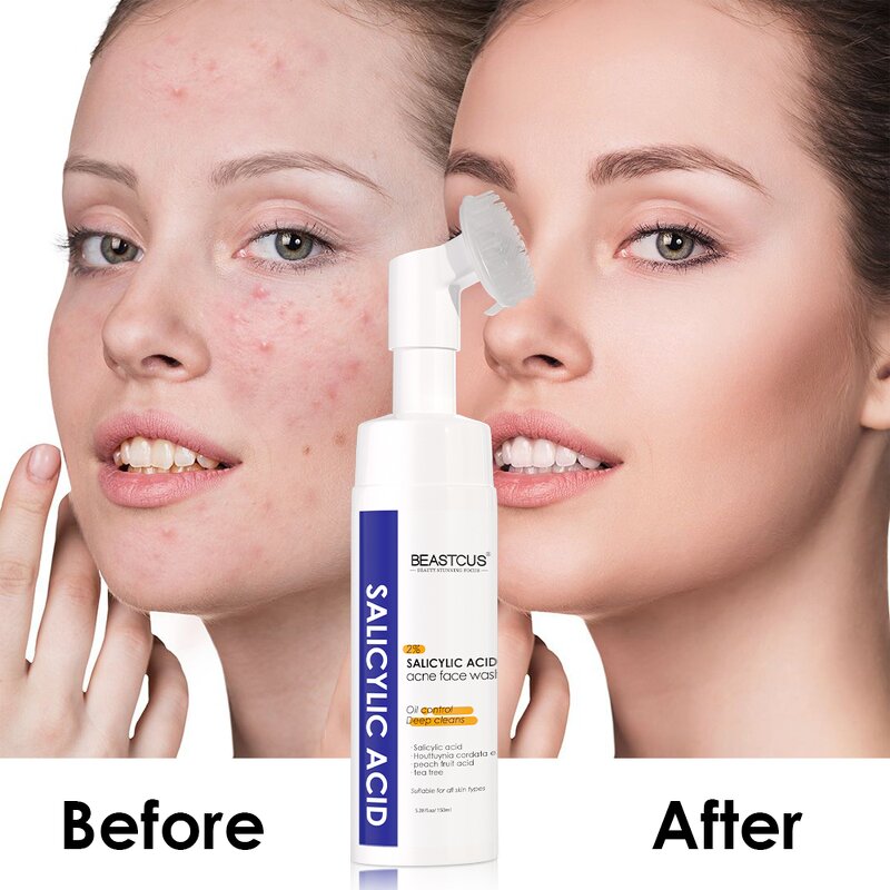 Facial Cleanser Manufacturer - Salicylic Acid HEARTLEAF Amino Acid - Foaming Face Wash