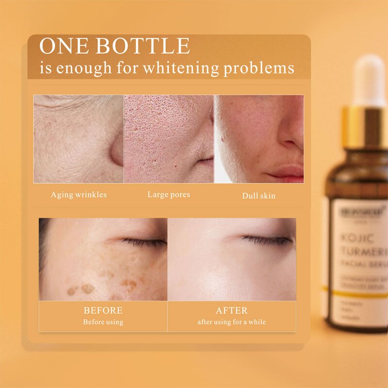 Vitamin C Serum Manufacturer - Kojic Acid Skincare - Dark Spots Remover & Whitening