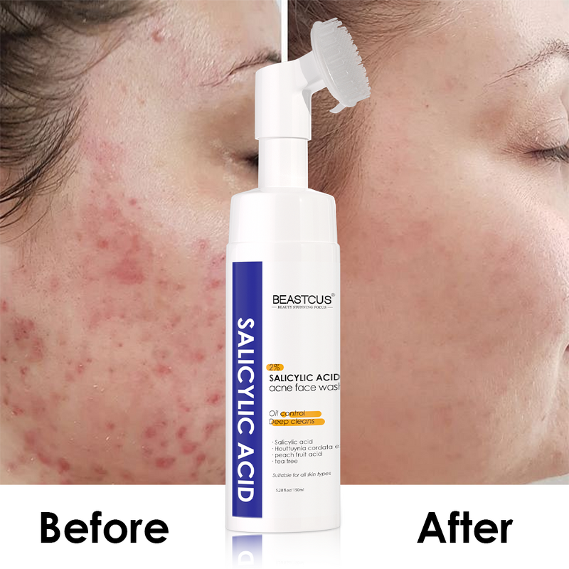 Facial Foam Cleanser Manufacturer - Acne Treatment Salicylic Acid - HEARTLEAF Mousse