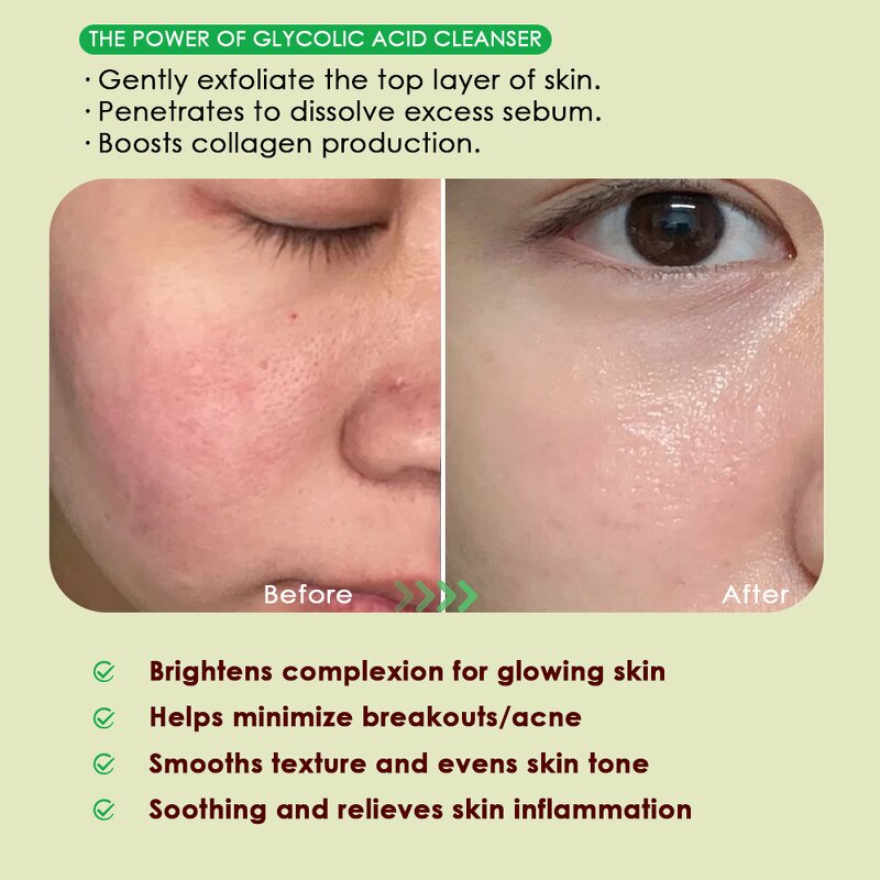 Facial Cleanser Manufacturer - Organic Foaming - Daily Moisturizing & Whitening