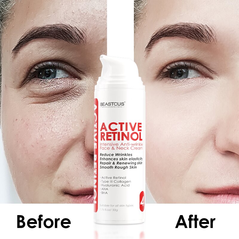 Wrinkle Cream Manufacturer - Plant Collagen - Anti-Aging Wrinkle Remover Wholesale