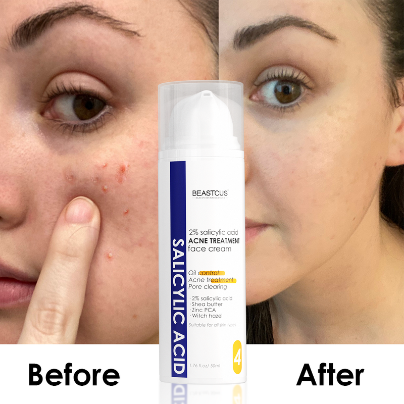 Freckle Cream Manufacturer - Anti Wrinkle Dark Spot - Strong Antiaging Collagen Retinol