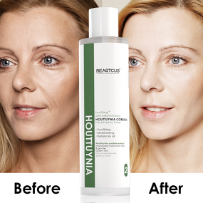 Face Toner Manufacturer - Korean Style Heartleaf Green Tea - Sensitive Skin