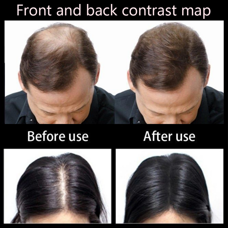 Hair Oil Manufacturer - Factory Supply Organic with Rosemary and Fenugreek Oils & Private Label