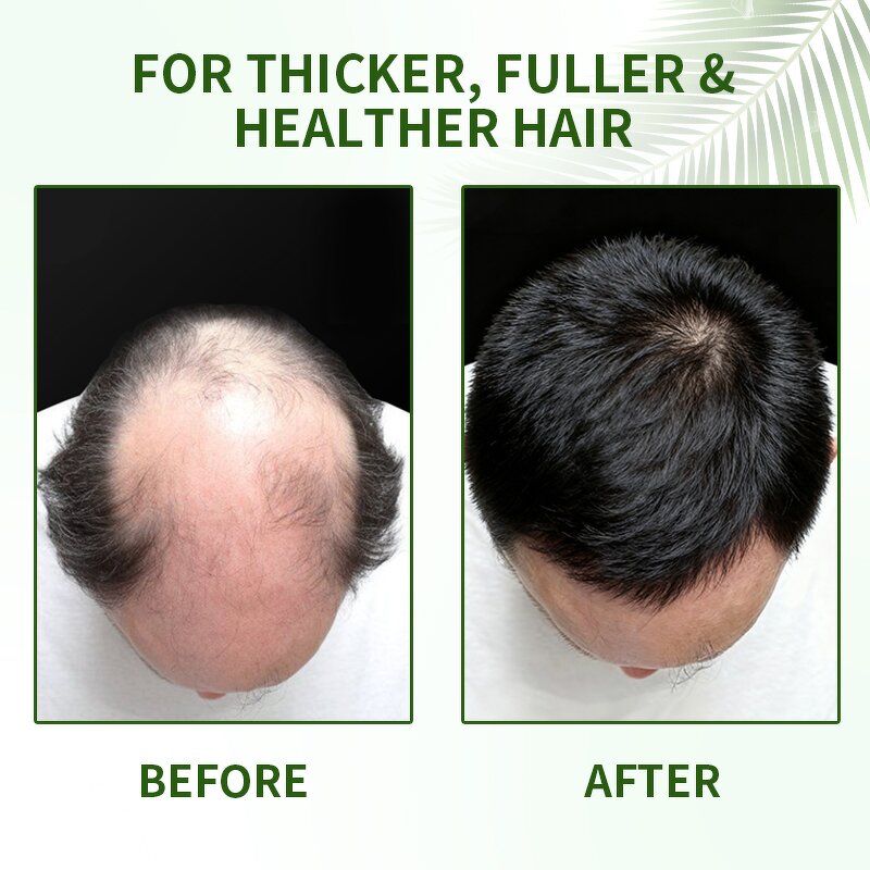 Batana Oil Manufacturer - Raw Bulk Organic 100% Pure Cold Pressed & Supplier 1kg