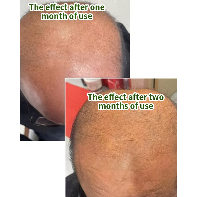 Hair Growth Oil Manufacturer - Natural Herbal for Thicker Hair Revitalize Scalp