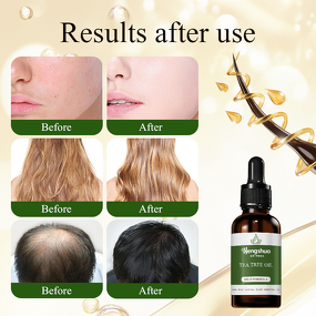 Tea Tree Essential Oil Manufacturer - High Quality Pure Natural Undiluted Wholesale & OEM