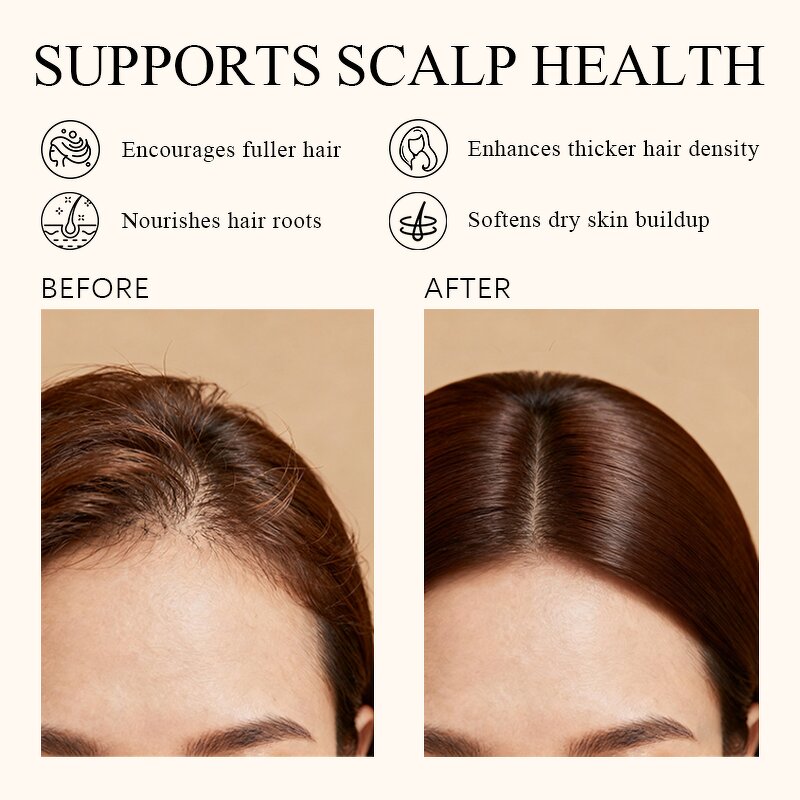 Hair Care Oil Manufacturer - High Quality 100% Natural Organic Treatment Essential Honey