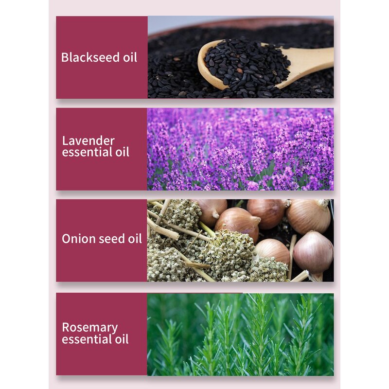 Hair Oil Manufacturer - Wholesale Organic Onion Black Seed Best Dandruff Treatment Growth Serum