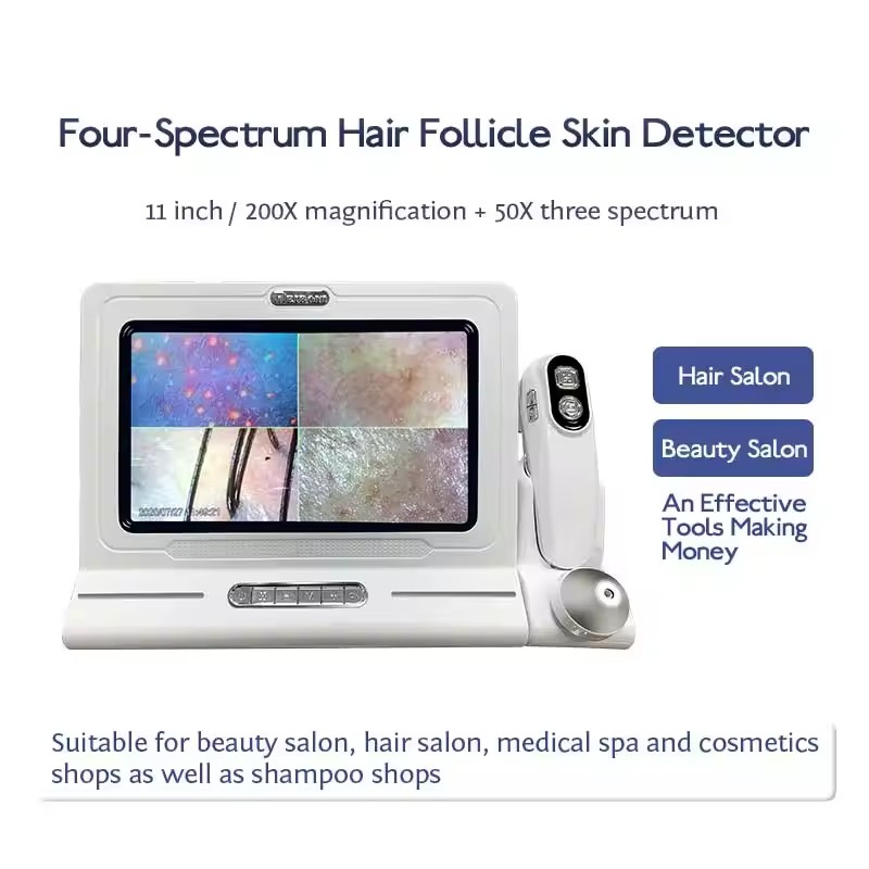 Hair Follicle Scanner Manufacturer - HD Scalp Detector Analysis