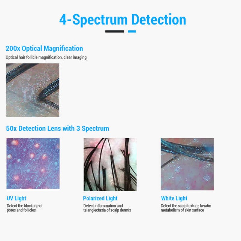 Scalp Scanner Manufacturer - 15 Inch Screen Hair Analyzer