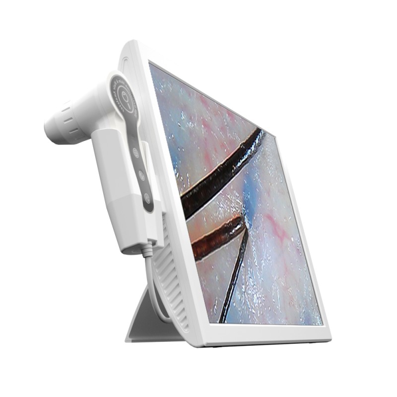 Scalp Scanner Manufacturer - 15 Inch Screen Hair Analyzer