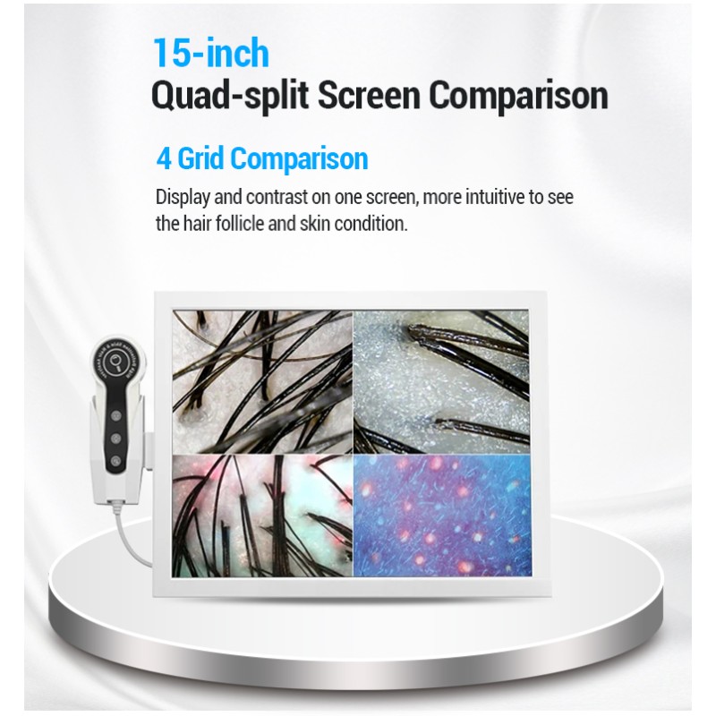 Scalp Scanner Manufacturer - 15 Inch Screen Hair Analyzer