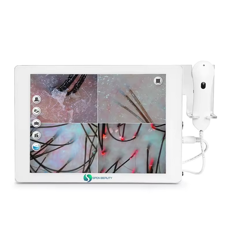 Hair Scalp Scanner Supplier - Touch Screen Analysis Machine