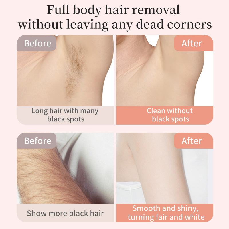 Dual Electric Shaver Manufacturer - USB Rechargeable Hair Removal