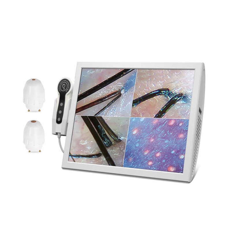 Scalp Scanner Manufacturer - 15 Inch Screen Hair Analyzer