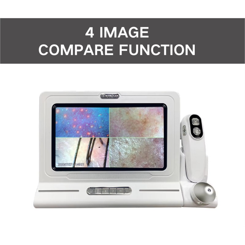 Hair Follicle Scanner Manufacturer - HD Scalp Detector Analysis