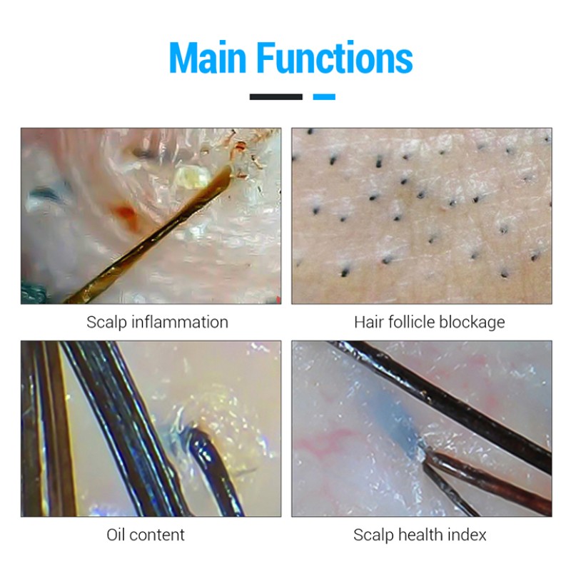 Scalp Scanner Manufacturer - 15 Inch Screen Hair Analyzer