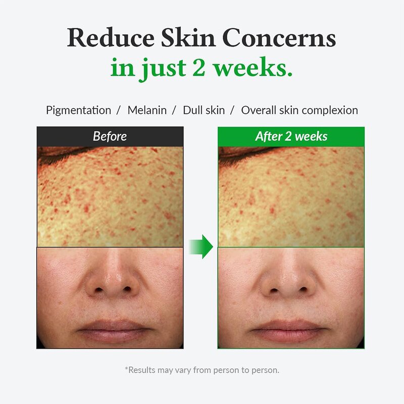 Teeth Whitening Pen Manufacturer - OEM Custom Fast Stain Removal for Coffee Tea Smoking Teeth