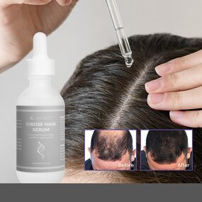 Blackhead Removal Serum Manufacturer - Private Label Green Tea Camellia Pore Shrinking Anti-Acne