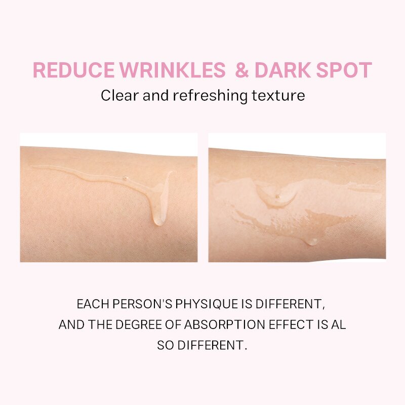 Collagen Threads Manufacturer - Custom Logo Soluble Face Line Protein - Reduce Fine Lines Wrinkle Tightening