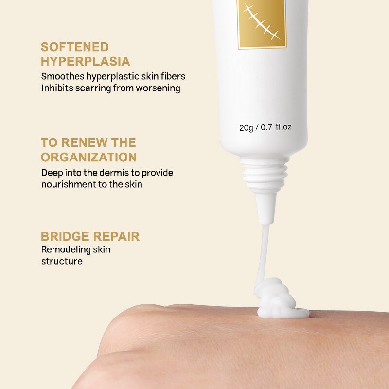 Peeling Oil Manufacturer - OEM ODM Custom Extra Strong for Body Skin Whitening Stretch Marks Remover